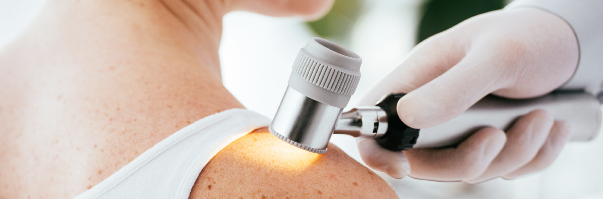 Verrugas o moluscos contagiosos: ¿cómo diferenciarlos?